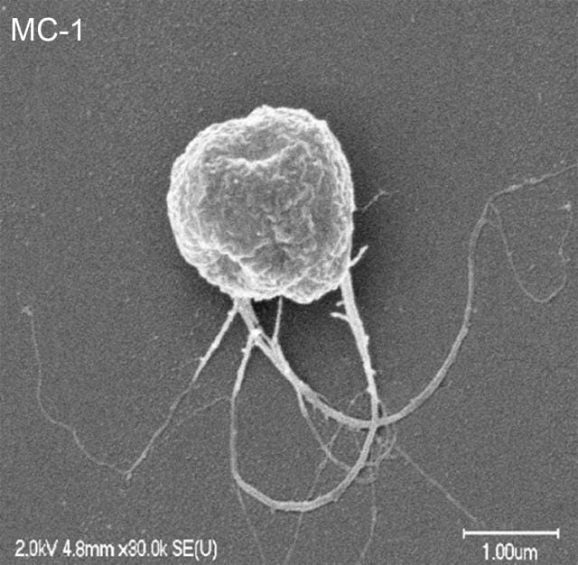 3062901 inline 2 these nanobots can deliver cancer drugs directly to tumors so chemo sucks less and works bet11