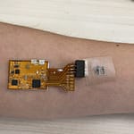 ניטור שחפת באמצעות מדבקה הנצמדת לעור ומודדת את החלקיקים הנדיפים הנפלטים ממנו. קרדיט: דוברות הטכניון